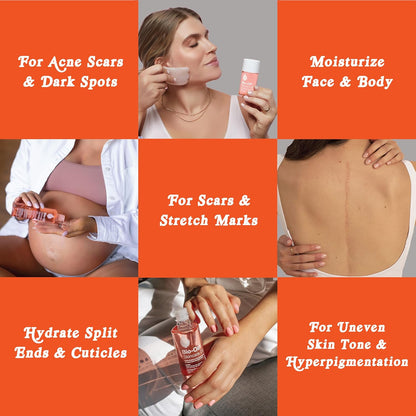 Bio-Oil Skincare Oil, 6.7 Ounce, Body Oil for Scars and Stretchmarks, Hydrates Skin, Non-Greasy